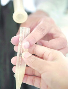 精液发黄